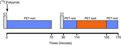 PET Imaging of Dopamine Neurotransmission During EEG Neurofeedback